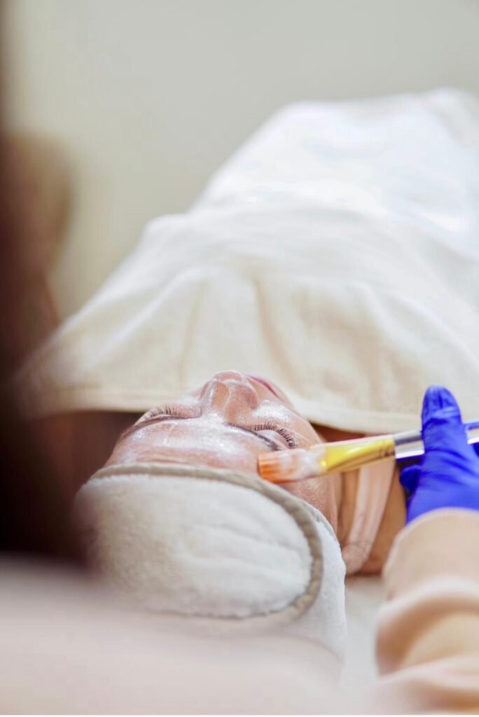 Chemical Peels
